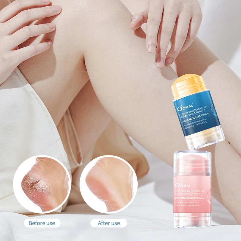 Heels - Crema antiagrietamiento para pies y talones